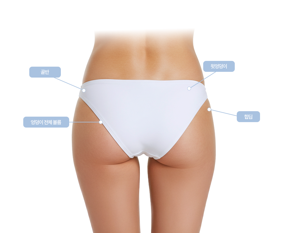 힙,골반필러 클레어 시그니처