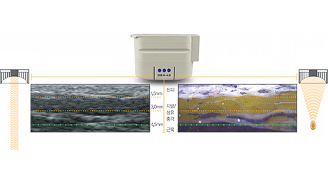 어깨필러 클레어 시그니처