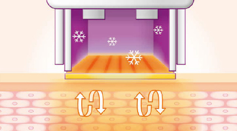 써마지FLX 리프팅